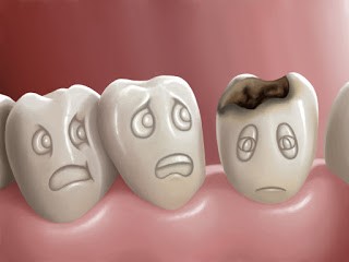 معایب و مزایای روکش کردن دندان