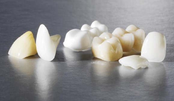 اجزاء ایمپلنت‌های دندانی