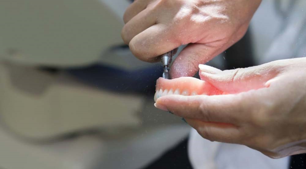 ریلاین کردن پروتزهای مصنوعی دندانی