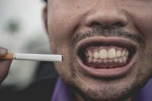 اثر سیگار کشیدن بر دندان
