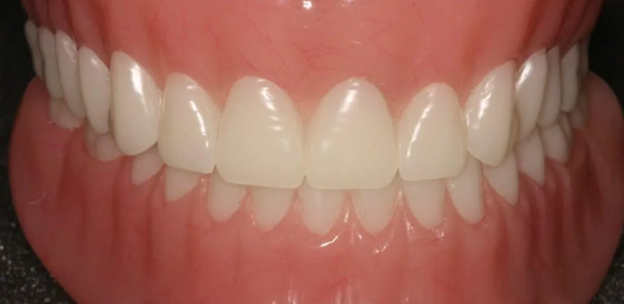 مشکلات پروتزهای مصنوعی دندانی